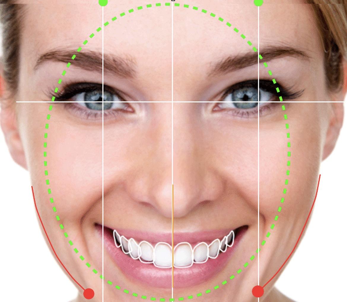 estetik diş hekimliği